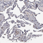 AHR Antibody in Immunohistochemistry (Paraffin) (IHC (P))