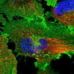 GLUT1 Antibody in Immunocytochemistry (ICC/IF)