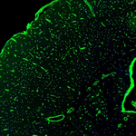 GLUT1 Antibody in Immunohistochemistry (Paraffin) (IHC (P))