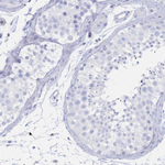 GLUT1 Antibody in Immunohistochemistry (Paraffin) (IHC (P))