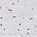 GLUT1 Antibody in Immunohistochemistry (Paraffin) (IHC (P))