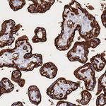 GLUT1 Antibody in Immunohistochemistry (Paraffin) (IHC (P))