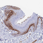 GLUT1 Antibody in Immunohistochemistry (Paraffin) (IHC (P))