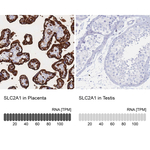 GLUT1 Antibody in Immunohistochemistry (Paraffin) (IHC (P))