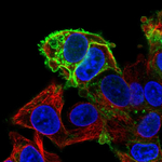 GLUT1 Antibody in Immunocytochemistry (ICC/IF)