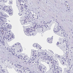 GLUT1 Antibody in Immunohistochemistry (Paraffin) (IHC (P))