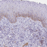GLUT1 Antibody in Immunohistochemistry (Paraffin) (IHC (P))