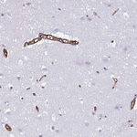 GLUT1 Antibody in Immunohistochemistry (Paraffin) (IHC (P))