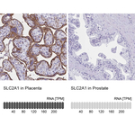 GLUT1 Antibody in Immunohistochemistry (Paraffin) (IHC (P))