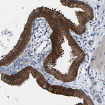 alpha-ENaC Antibody in Immunohistochemistry (Paraffin) (IHC (P))