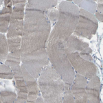 alpha-ENaC Antibody in Immunohistochemistry (Paraffin) (IHC (P))