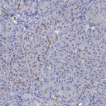 CFTR Antibody in Immunohistochemistry (Paraffin) (IHC (P))