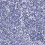 CFTR Antibody in Immunohistochemistry (Paraffin) (IHC (P))