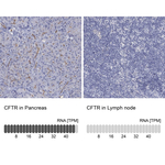 CFTR Polyclonal Antibody