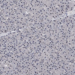 PSD93 Antibody in Immunohistochemistry (Paraffin) (IHC (P))