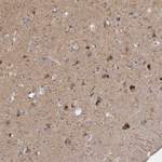 PSD93 Antibody in Immunohistochemistry (Paraffin) (IHC (P))