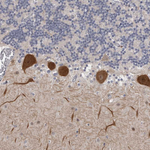 PSD93 Antibody in Immunohistochemistry (Paraffin) (IHC (P))