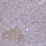 WNK1 Antibody in Immunohistochemistry (Paraffin) (IHC (P))