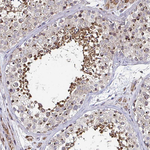 ATG3 Antibody in Immunohistochemistry (Paraffin) (IHC (P))