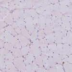 ATG3 Antibody in Immunohistochemistry (Paraffin) (IHC (P))