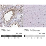 ATG3 Antibody in Immunohistochemistry (Paraffin) (IHC (P))