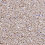 NF-H Antibody in Immunohistochemistry (Paraffin) (IHC (P))