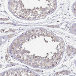 NF-H Antibody in Immunohistochemistry (Paraffin) (IHC (P))