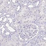 NF-H Antibody in Immunohistochemistry (Paraffin) (IHC (P))