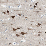 PSD-95 Antibody in Immunohistochemistry (Paraffin) (IHC (P))