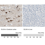 PSD-95 Antibody in Immunohistochemistry (Paraffin) (IHC (P))