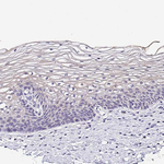 GABBR2 Antibody in Immunohistochemistry (Paraffin) (IHC (P))