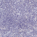GABBR2 Antibody in Immunohistochemistry (Paraffin) (IHC (P))