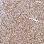 GABBR2 Antibody in Immunohistochemistry (Paraffin) (IHC (P))