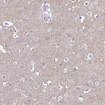 GABBR2 Antibody in Immunohistochemistry (Paraffin) (IHC (P))