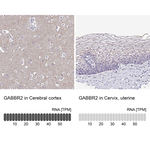 GABBR2 Polyclonal Antibody