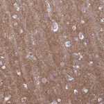 GABBR2 Antibody in Immunohistochemistry (Paraffin) (IHC (P))