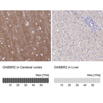 GABBR2 Polyclonal Antibody