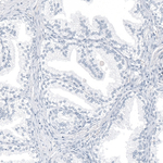 TrkA Antibody in Immunohistochemistry (Paraffin) (IHC (P))