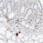 TrkA Polyclonal Antibody