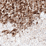 TrkA Antibody in Immunohistochemistry (Paraffin) (IHC (P))