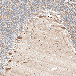 TrkA Antibody in Immunohistochemistry (Paraffin) (IHC (P))