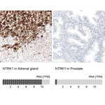 TrkA Antibody in Immunohistochemistry (Paraffin) (IHC (P))