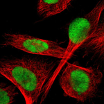 TLK1 Antibody in Immunocytochemistry (ICC/IF)