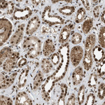 TLK1 Antibody in Immunohistochemistry (Paraffin) (IHC (P))