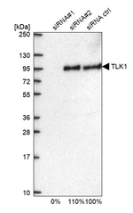 TLK1 Antibody in Western Blot (WB)