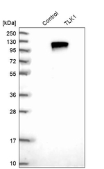 TLK1 Antibody in Western Blot (WB)
