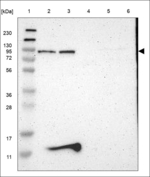 GALNT8 Polyclonal Antibody