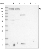 KIAA1549L Polyclonal Antibody