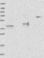 ADPRHL2 Antibody in Western Blot (WB)