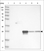 KRTAP10-8 Polyclonal Antibody